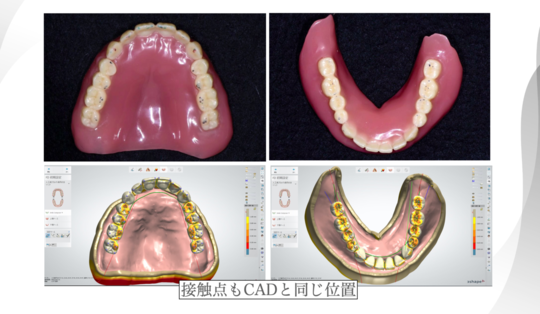 1円～ 歯科 器具 まとめて セット 歯型 人工歯 CROWN クラウン